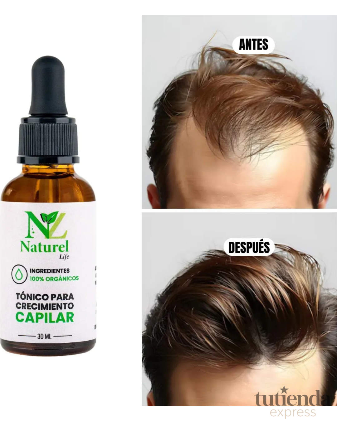 Tónico Capilar Naturel Life – Crecimiento y Anticaída